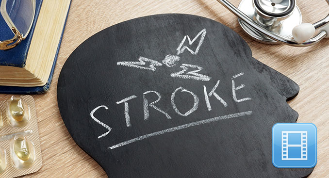 Risk Factors and Signs of a Stroke