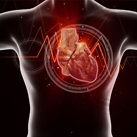 Catheter Ablation for Atrial Fibrillation: How Does it Work?