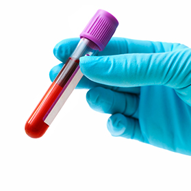 New Blood Test May Predict Heart Attack Risk