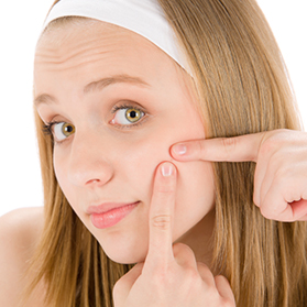 5 Acne Myths Busted