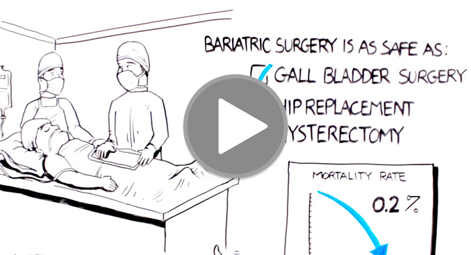 Bariatric Surgery - Know the Facts