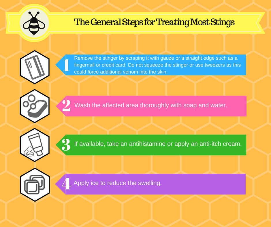 Treating a bee sting infographic