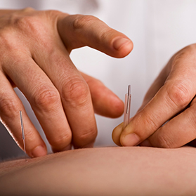 Why Acupuncture?