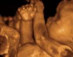 4D-ultrasound-image
