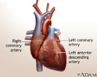 ADAM - heart bypass surgery - series_200x