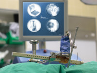 Robotic-assisted surgery ensures consistent accuracy and safety to patients.