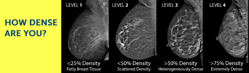 TriHealth Breast Density Classification